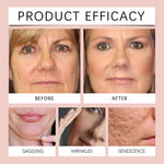 Conjunto de mascarilla Facial de colágeno